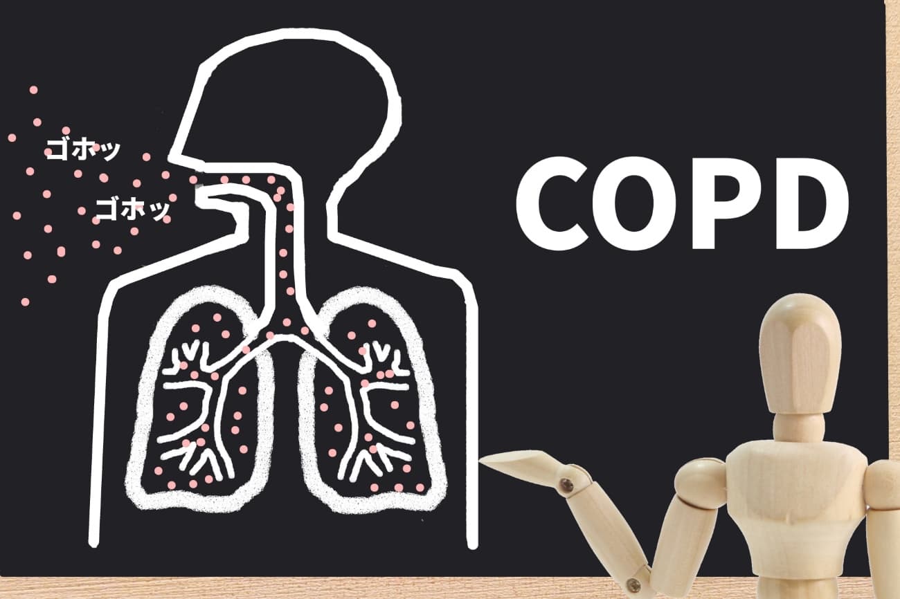 COPD（慢性閉塞性肺疾患）のイメージ画像